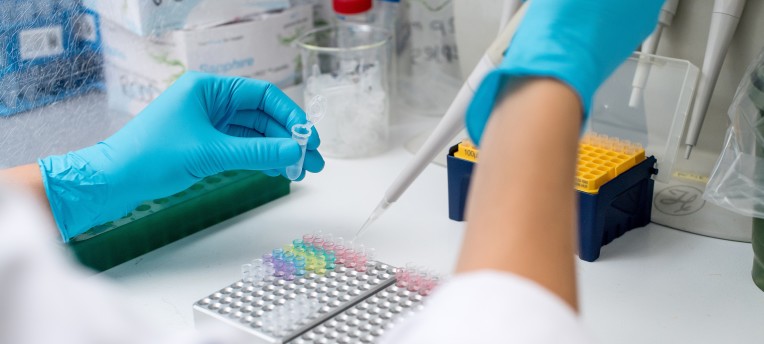 New DNA Multiscan protocol for water samples